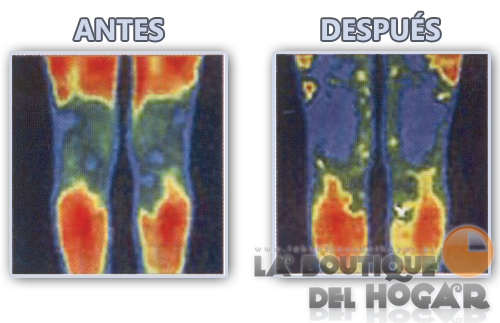 Equipo de Presoterapia Profesional + Electroestimulación + Termoterapia 3  en 1 Electro-Beauty Sculpt